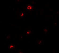 Invitrogen Pellino 1 Polyclonal Antibody 100 &mu;g; Unconjugated:Antibodies,