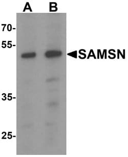 Invitrogen SAMSN1 Polyclonal Antibody 100 &mu;g; Unconjugated:Antibodies,