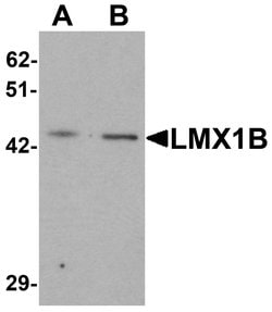 Invitrogen LMX1B Polyclonal Antibody 100 &mu;g; Unconjugated:Antibodies,