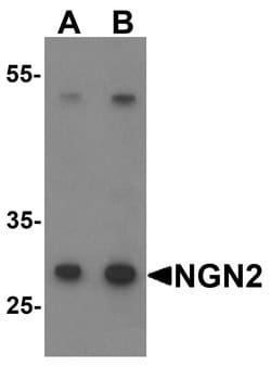 Invitrogen Neurogenin 2 Polyclonal Antibody 100 &mu;g; Unconjugated:Antibodies,