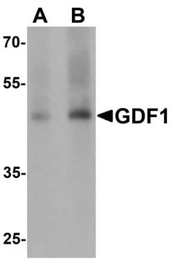 Invitrogen GDF1 Polyclonal Antibody 100 &mu;g | Buy Online | Invitrogen&trade; | Fisher Scientific