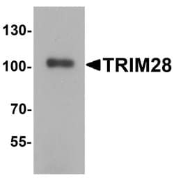 TRIM28 Polyclonal Antibody:Antibodies, Polyclonal