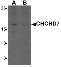 Invitrogen CHCHD7 Polyclonal Antibody 100 &mu;g; Unconjugated:Antibodies,