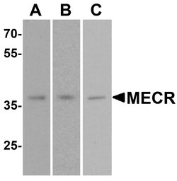 Invitrogen MECR Polyclonal Antibody 100 &mu;g; Unconjugated:Antibodies,