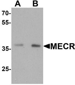 Invitrogen MECR Polyclonal Antibody 100 &mu;g; Unconjugated:Antibodies,
