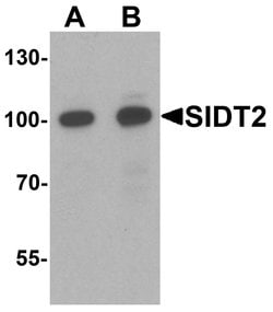 SIDT2 Polyclonal Antibody:Antibodies, Polyclonal