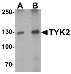 Invitrogen TYK2 Polyclonal Antibody 100 &mu;g | Buy Online | Invitrogen&trade; | Fisher Scientific