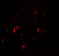 CRTH2 Polyclonal Antibody:Antibodies, Polyclonal