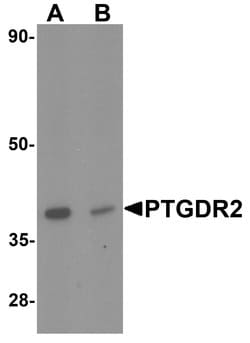 CRTH2 Polyclonal Antibody:Antibodies, Polyclonal
