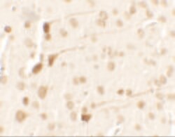 Invitrogen TPT1 Polyclonal Antibody 100 &mu;g | Buy Online | Invitrogen&trade; | Fisher Scientific
