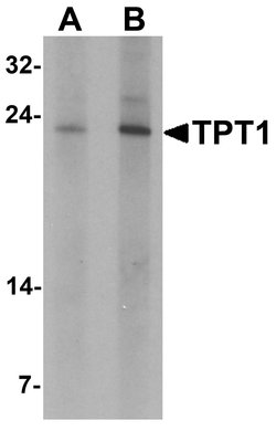 Invitrogen TPT1 Polyclonal Antibody 100 &mu;g | Buy Online | Invitrogen&trade; | Fisher Scientific
