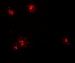 Invitrogen MCP-1 Polyclonal Antibody 100 &mu;g | Buy Online | Invitrogen&trade; | Fisher Scientific