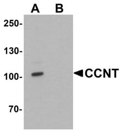 Invitrogen Cyclin T1 Polyclonal Antibody 100 μg; Unconjugated:Antibodies,