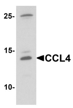 Invitrogen CCL4 Polyclonal Antibody 100 &mu;g; Unconjugated:Anticuerpos