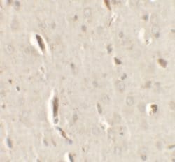 GRIP1 Polyclonal Antibody:Antibodies, Polyclonal