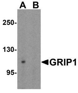 GRIP1 Polyclonal Antibody:Antibodies, Polyclonal