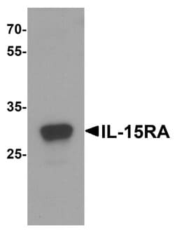 Invitrogen IL15RA Polyclonal Antibody 100 &mu;g; Unconjugated:Antibodies,