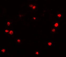 Invitrogen PIBF1 Polyclonal Antibody 100 &mu;g; Unconjugated:Antibodies,