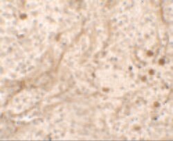 Invitrogen PIBF1 Polyclonal Antibody 100 &mu;g; Unconjugated:Antibodies,