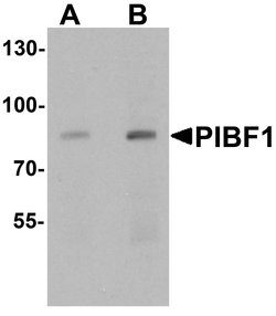 Invitrogen PIBF1 Polyclonal Antibody 100 &mu;g; Unconjugated:Antibodies,