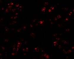 Invitrogen TARC Polyclonal Antibody 100 &mu;g; Unconjugated:Antibodies,