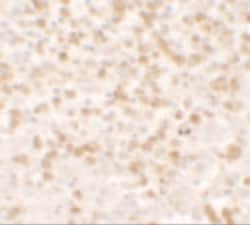 Invitrogen TARC Polyclonal Antibody 100 &mu;g; Unconjugated:Antibodies,