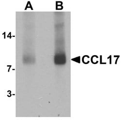 Invitrogen TARC Polyclonal Antibody 100 &mu;g; Unconjugated:Antibodies,