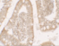 Invitrogen RC3H1 Polyclonal Antibody 100 &mu;g; Unconjugated:Antibodies,