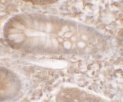 Invitrogen KREMEN1 Polyclonal Antibody 100 &mu;g; Unconjugated:Antibodies,