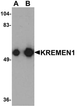Invitrogen KREMEN1 Polyclonal Antibody 100 &mu;g; Unconjugated:Antibodies,