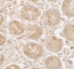 Invitrogen SHISA3 Polyclonal Antibody 100 &mu;g; Unconjugated:Antibodies,