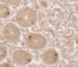 Invitrogen MTERFD2 Polyclonal Antibody 100 &mu;g; Unconjugated:Antibodies,