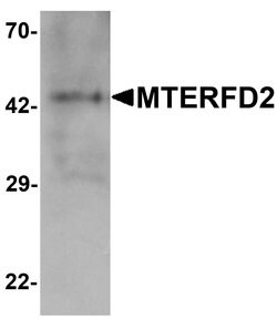 Invitrogen MTERFD2 Polyclonal Antibody 100 &mu;g; Unconjugated:Antibodies,