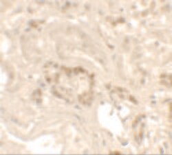 Invitrogen KANK1 Polyclonal Antibody 100 &mu;g | Buy Online | Invitrogen&trade; | Fisher Scientific