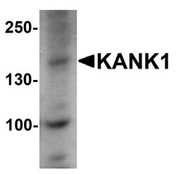 Invitrogen KANK1 Polyclonal Antibody 100 &mu;g | Buy Online | Invitrogen&trade; | Fisher Scientific
