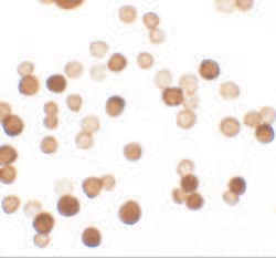 Invitrogen ERRF Polyclonal Antibody 100 &mu;g; Unconjugated:Antibodies,