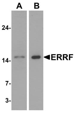 Invitrogen ERRF Polyclonal Antibody 100 &mu;g; Unconjugated:Antibodies,
