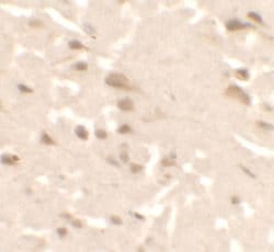 Invitrogen ULK2 Polyclonal Antibody 100 &mu;g | Buy Online | Invitrogen&trade; | Fisher Scientific