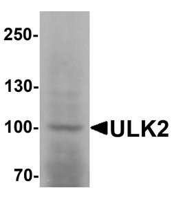 Invitrogen ULK2 Polyclonal Antibody 100 &mu;g | Buy Online | Invitrogen&trade; | Fisher Scientific