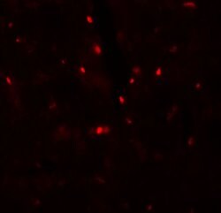 Invitrogen SLC27A6 Polyclonal Antibody 100 &mu;g; Unconjugated:Antibodies,