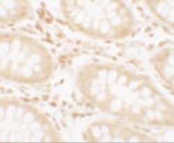 Invitrogen Torc2 Polyclonal Antibody 100 &mu;g; Unconjugated:Antibodies,