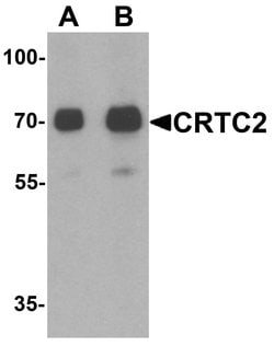 Invitrogen Torc2 Polyclonal Antibody 100 &mu;g; Unconjugated:Antibodies,