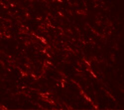 TIP60 Polyclonal Antibody:Antibodies, Polyclonal