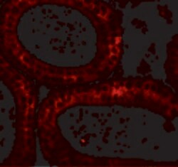 Invitrogen DIS3 Polyclonal Antibody 100 &mu;g; Unconjugated:Antibodies,