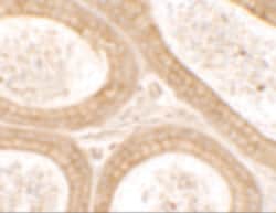 Invitrogen DIS3 Polyclonal Antibody 100 &mu;g; Unconjugated:Antibodies,