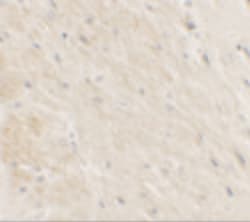 Invitrogen DDX41 Polyclonal Antibody 100 &mu;g; Unconjugated:Antibodies,