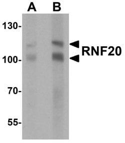 RNF20 Polyclonal Antibody, Invitrogen 100 &mu;g; Unconjugated:Antibodies,