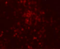 Invitrogen TLX3 Polyclonal Antibody 100 &mu;g; Unconjugated:Antibodies,