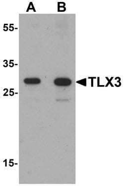 Invitrogen TLX3 Polyclonal Antibody 100 &mu;g; Unconjugated:Antibodies,