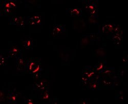 Invitrogen TRIM24 Polyclonal Antibody 100 &mu;g; Unconjugated:Antibodies,
